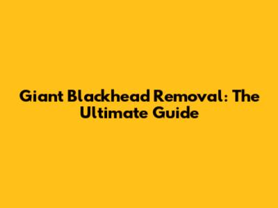 Giant Blackhead Removal: The Ultimate Guide